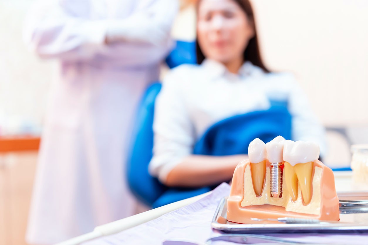 Dental Implants: A Possible Solution For Missing Or Damaged Teeth Dental Implants: A Possible Solution For Missing Or Damaged Teeth