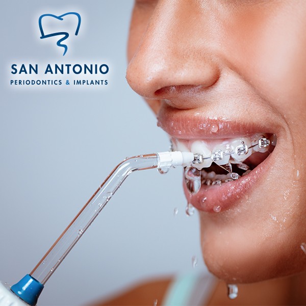 Flossing vs. Water Flossing