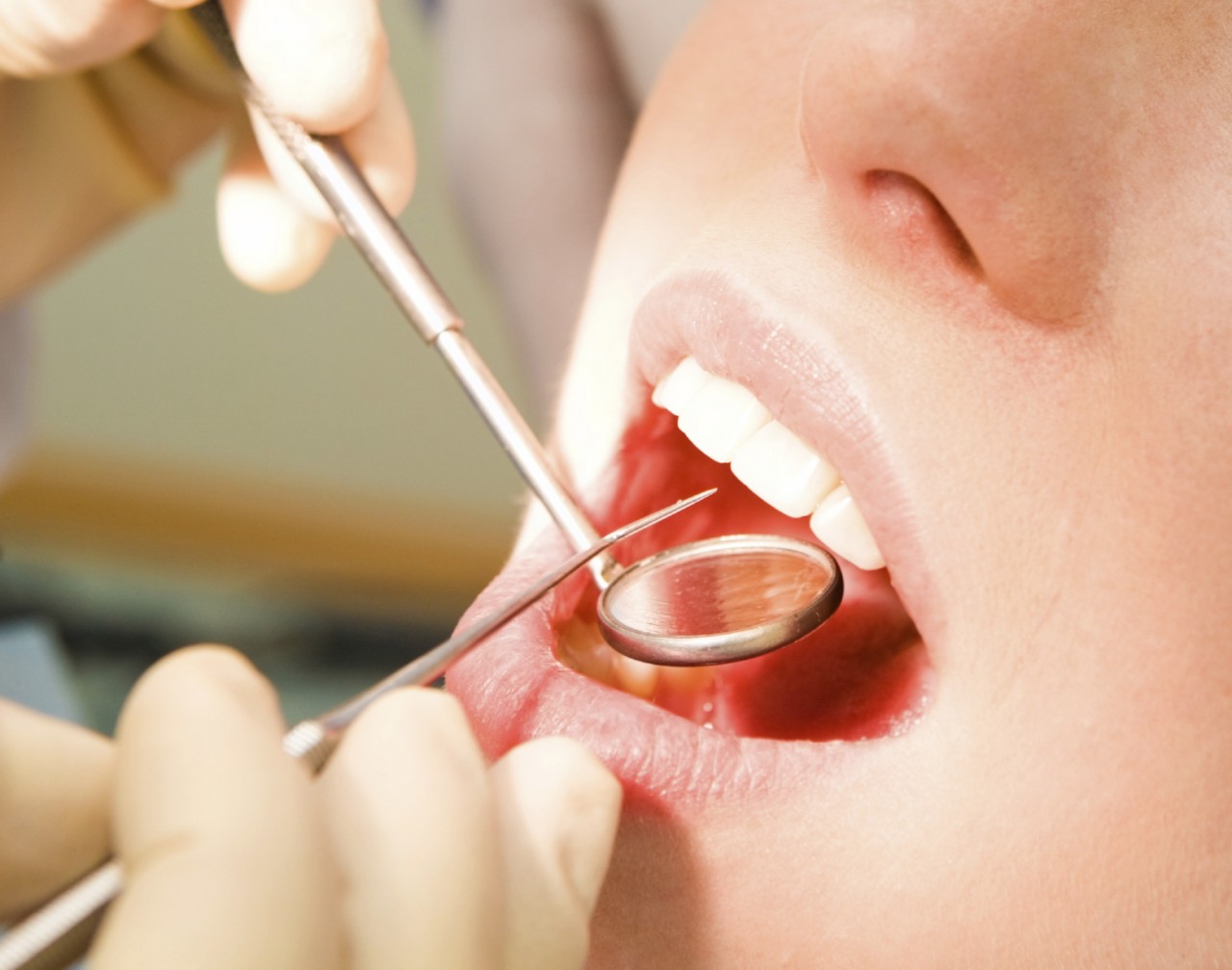 Is Gum Disease More Common In Women