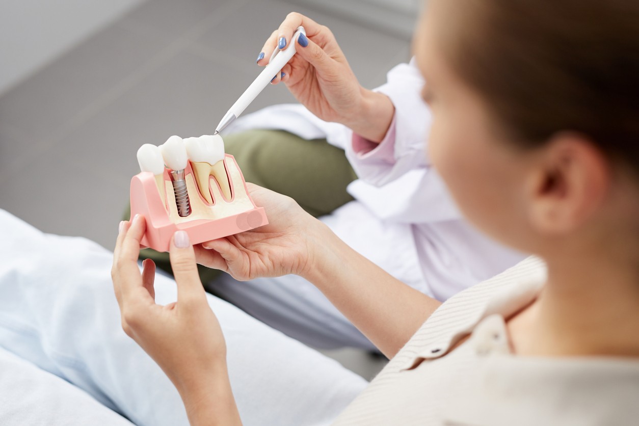 Smiling Behind the Mask – Dental Implants and Your Mental Health