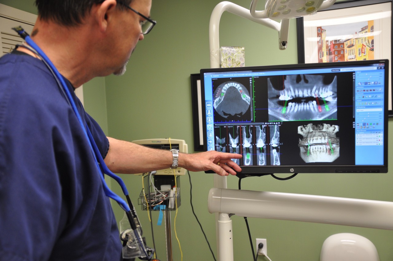 How Long Do Dental Implants Last?